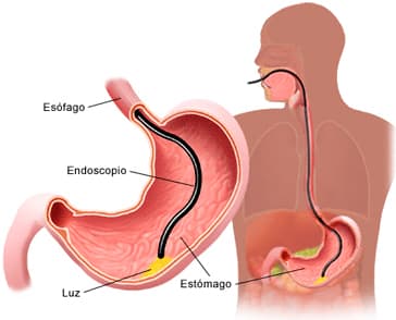 PREPARACIÓN, para Panendoscopia oral y Ecografía de Abdomen.