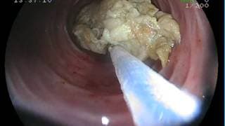 URGENCIA INSÓLITA.- Cuento de médico.