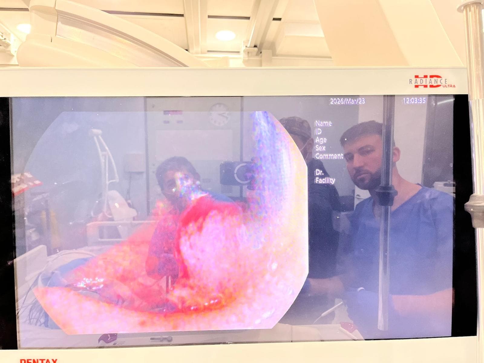 Hemorragia digestiva alta.