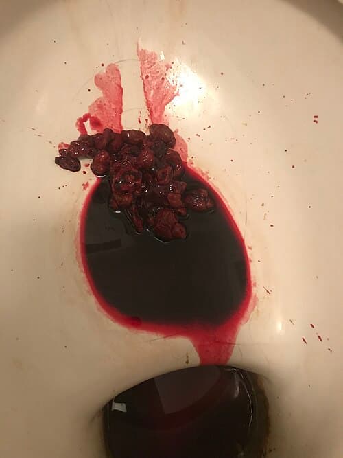 SANGRE EN LAS HECES ( Información para Pacientes).