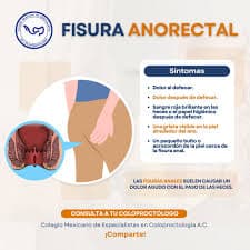 FISURA ANAL.