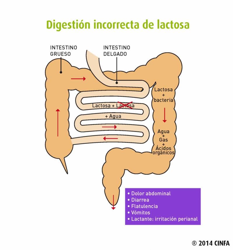 INTOLERANCIA A LA LACTOSA. Información para pacientes.